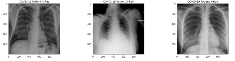 x ray scan of covid 19 affected 2